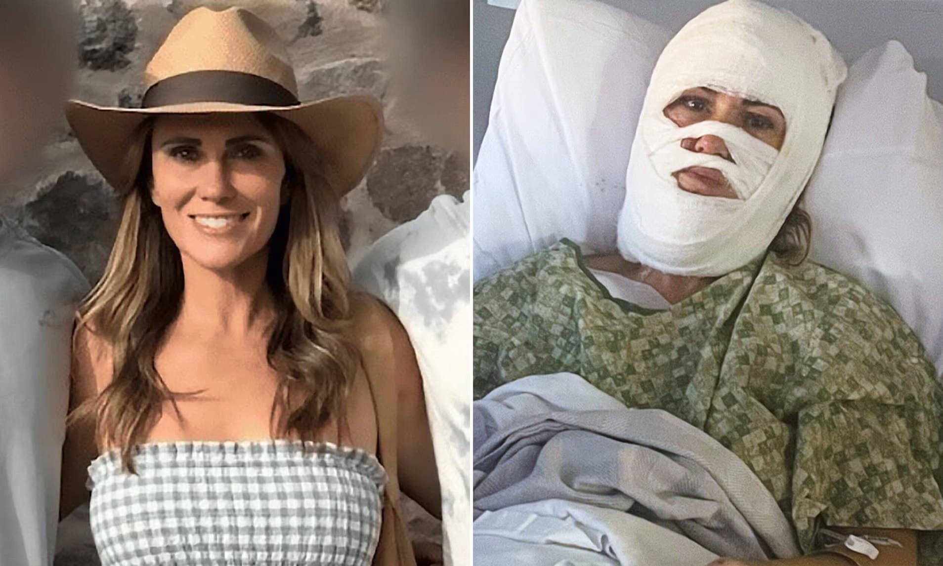 Featured image for: Georgia woman disfigured and facing millions in medical bills after acid attack Georgia woman disfigured and facing millions in medical bills after acid attack