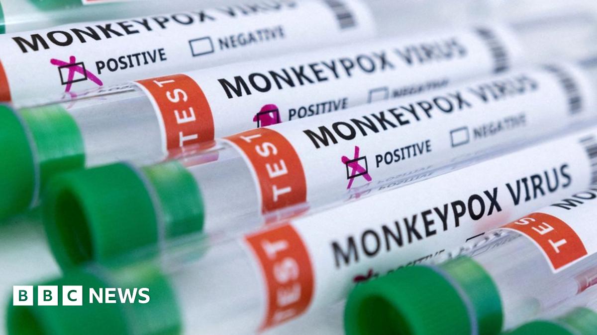 Kenya Launches Urgent Monkeypox Vaccination Campaign Next Week