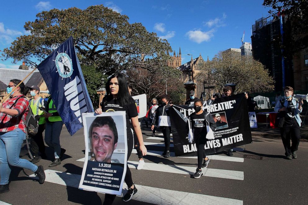 Activist Confronts Australian Politician, Disrupts Anti-Protest Interview