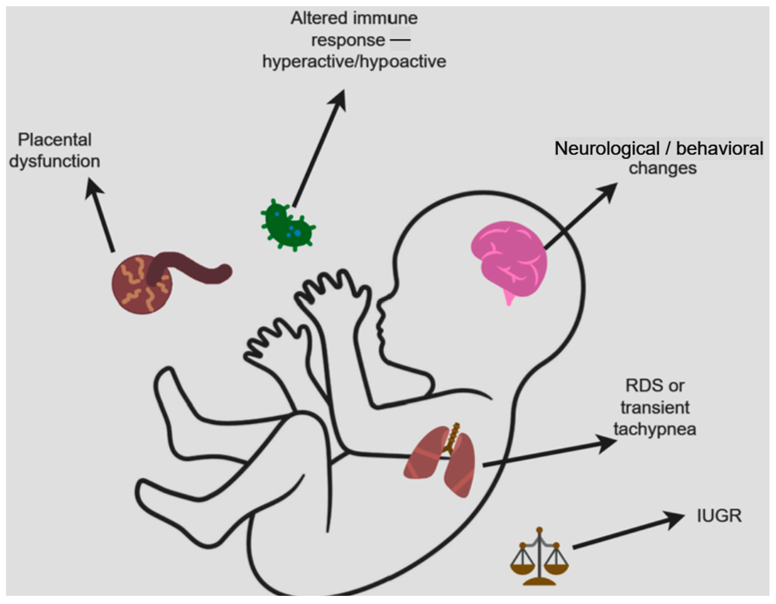 Image for Study finds COVID-19 during pregnancy increases autism risk in children