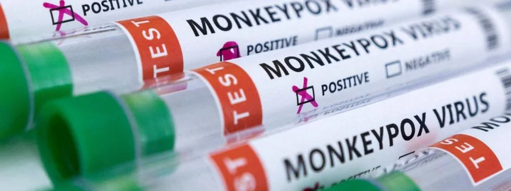 Kenya Launches Urgent Monkeypox Vaccination Campaign Next Week