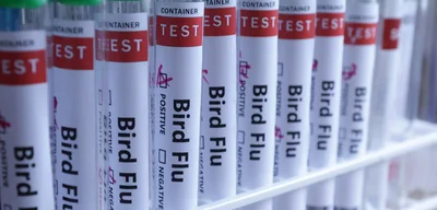 Mexico reports new human case of H5 bird flu in Mexico City