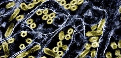 Person in Washington state tests positive for H5N5 bird flu