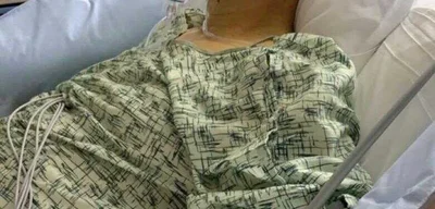 World’s First Liver Transplant to Cure Rare Blood Disorder Ignites Ethical Firestorm