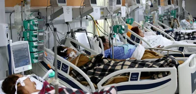 American Patients Face $0 Bills in Brazil's Public Health System While Millions Go Uninsured at Home