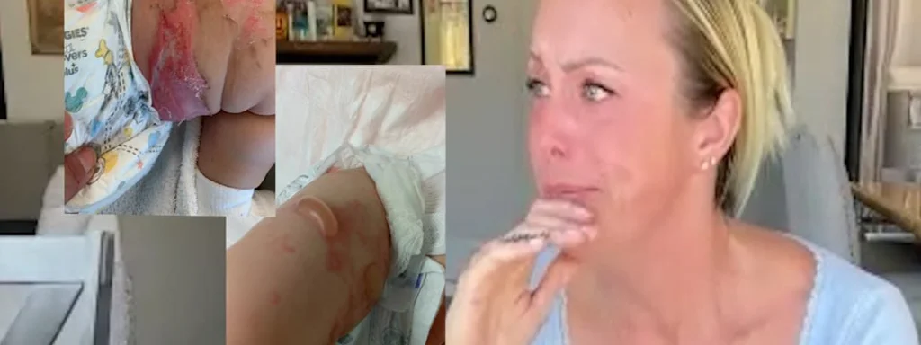 Mother Faces $100K Bill After Emergency Airlift for Burned Baby; Debt Resolved After Media Attention