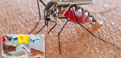 First Local Malaria Case in 27 Years Reported in New Jersey