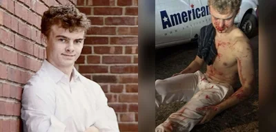 Heroic DOGE Employee Suffers Concussion While Defending Woman from Assault in DC