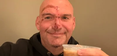 Senator John Fetterman released from hospital after fall