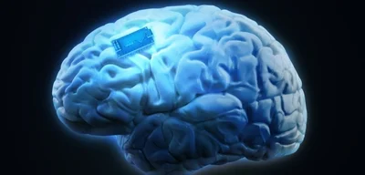 Stanford's Brain Implant Achieves 79% Accuracy in Decoding Inner Speech for ALS Patients