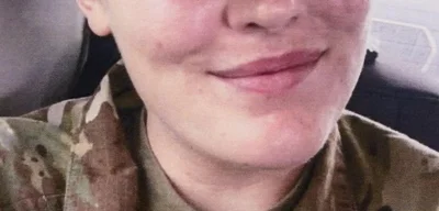 20-year-old National Guard member Sarah Beckstrom dies from injuries