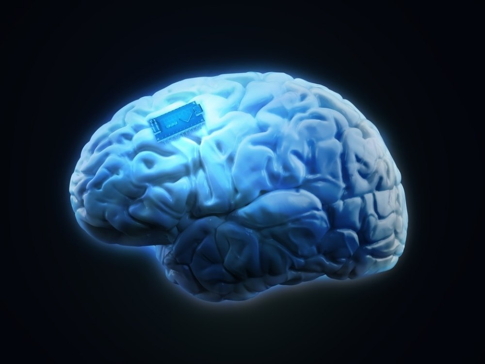 Stanford's Brain Implant Achieves 79% Accuracy in Decoding Inner Speech for ALS Patients